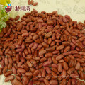 Chinese Manufacturer price of Light Red Kidney Beans/red lentils/canned bean Wholesale